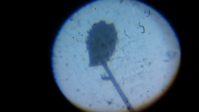 مشاهده ساختار قارچی کپک نان زیر میکروسکوپ؛
🔬آشنایی عملی با مراحل آماده سازی نمونه و کار با میکروسکوپ